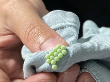 丹灶杀虫灭鼠站：吸血臭虫长什么样儿？